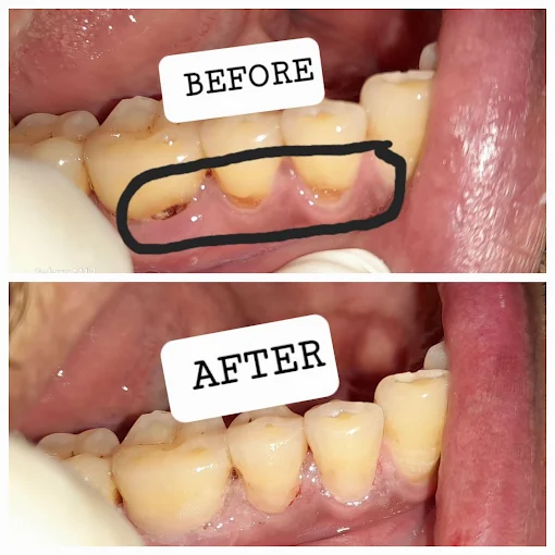 Pooja Smile Care Dental Gallery Image 25